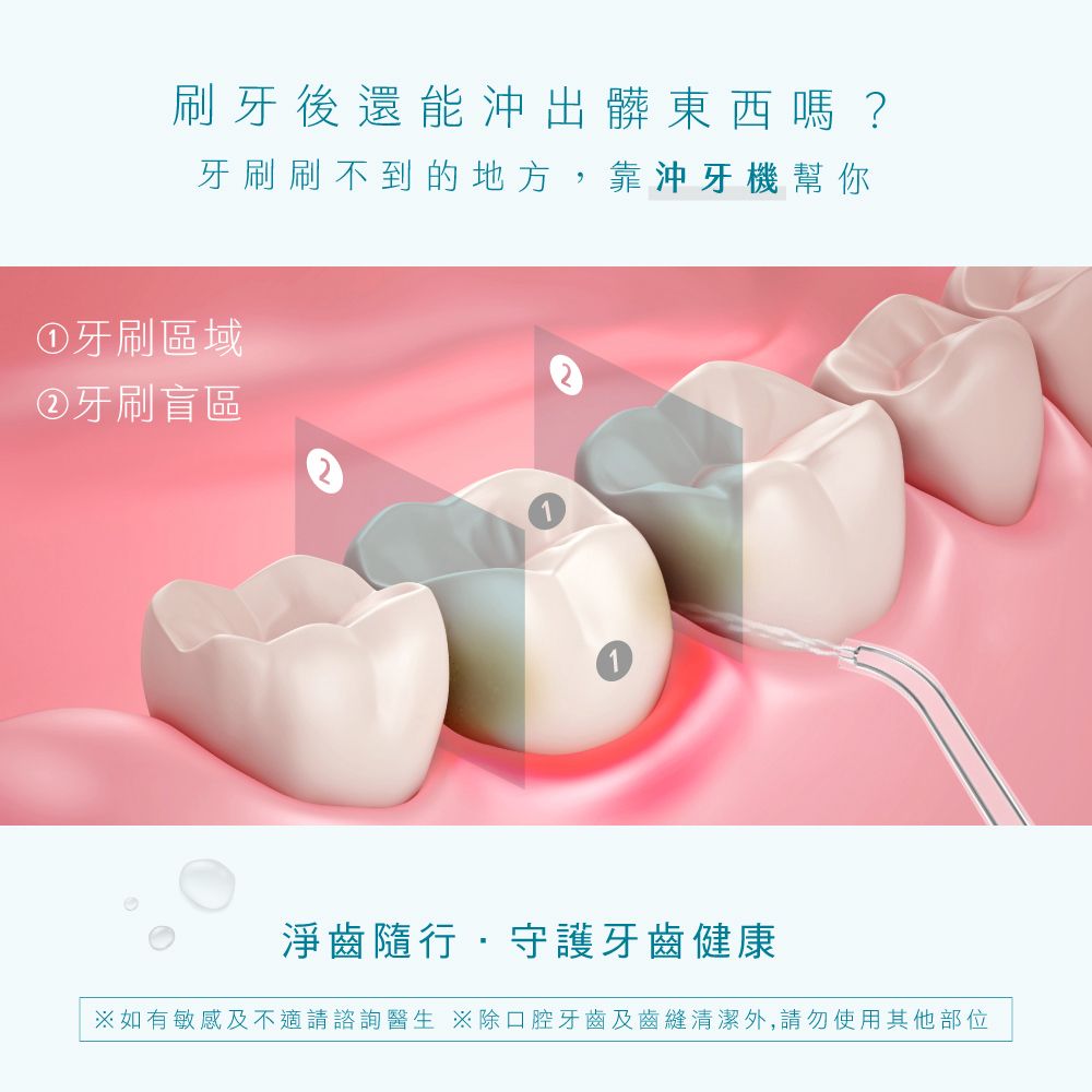 KINYO 伸縮沖牙機 隨身攜帶型潔牙器 USB充電沖齒機 脈衝洗牙器