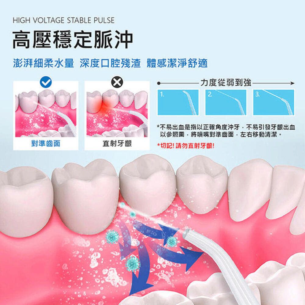  電動沖牙器 洗牙器 牙套清洗 便攜式