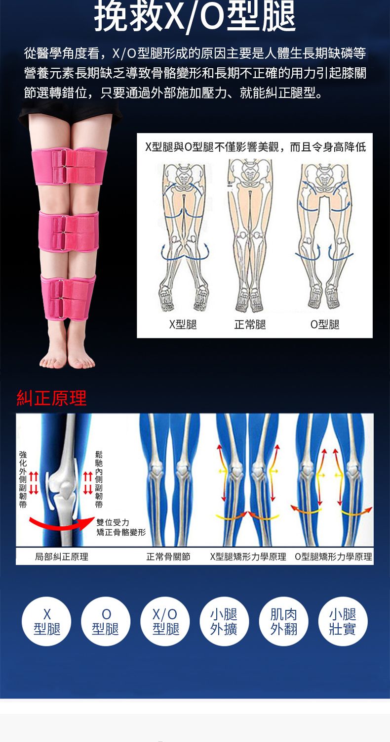 挽救型腿從醫學角度看,/O型腿形成的原因主要是人體生長期缺磷等營養元素長期缺乏導致骨骼變形和長期不正確的用力引起膝關節選轉錯位,只要通過外部施加壓力、就能糾正腿型。糾正原理X型腿與O型腿不僅影響美觀,而且令身高降低X型腿正常腿O型腿雙位受力矯正骨骼變形局部糾正原理正常骨關節X型腿矯形力學原理 O型腿矯形力學原理XX/O小腿肌肉小腿型腿型腿型腿外擴外翻壯實