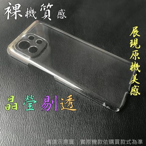 Xiaomi 小米 11 硬殼背蓋保護套-晶瑩剔透