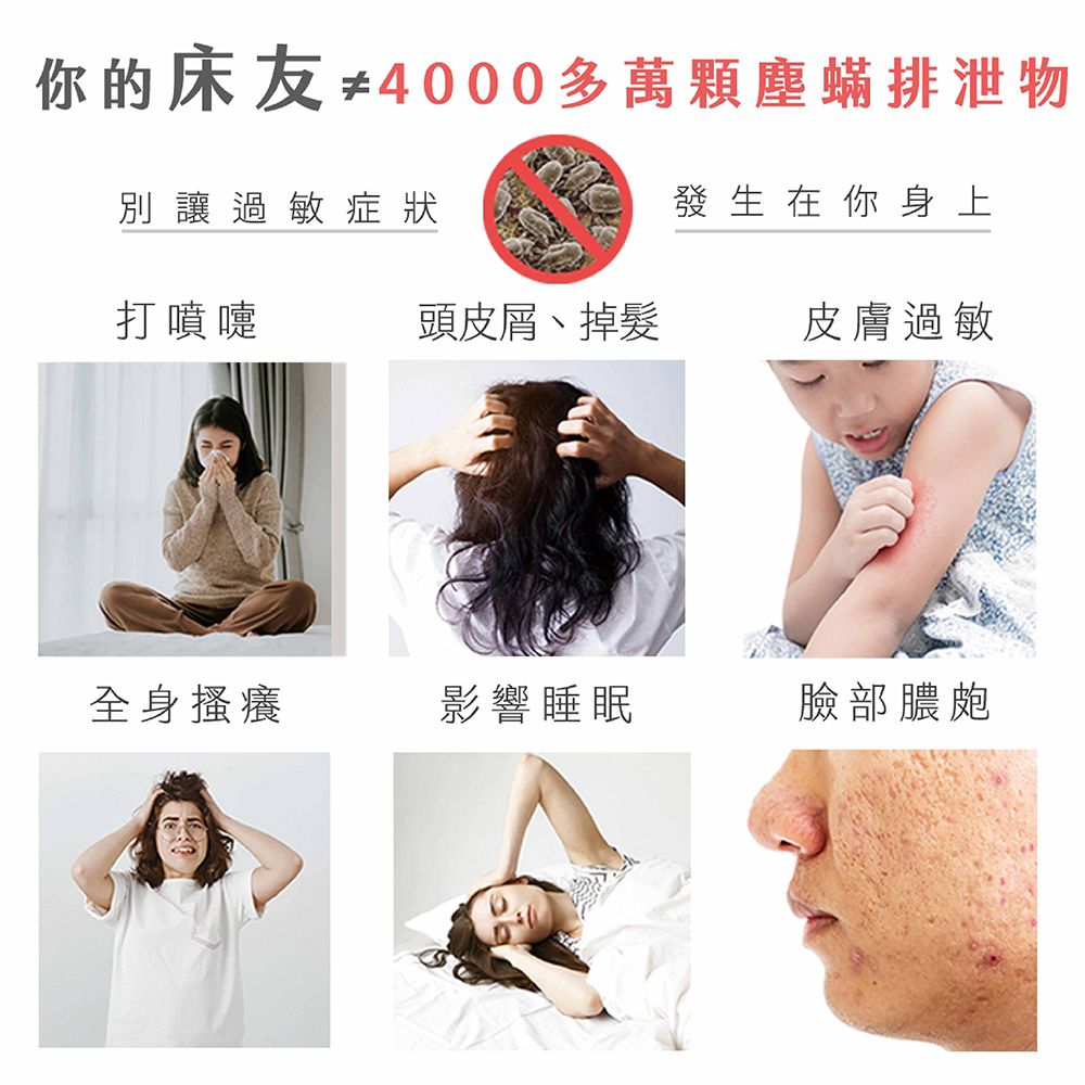 你的床友≠4000多萬顆塵蟎排泄物別讓過敏症狀發生在你身上打噴嚏頭皮屑、掉髮皮膚過敏全身搔癢影響睡眠臉部膿皰